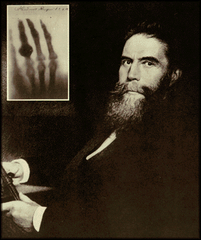 Wilhelm Conrad Rntgen